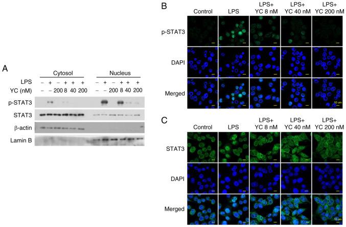 https://cdn.ncbi.nlm.nih.gov/pmc/blobs/076d/12277938/3744284bd165/etm-30-03-12918-g02.jpg