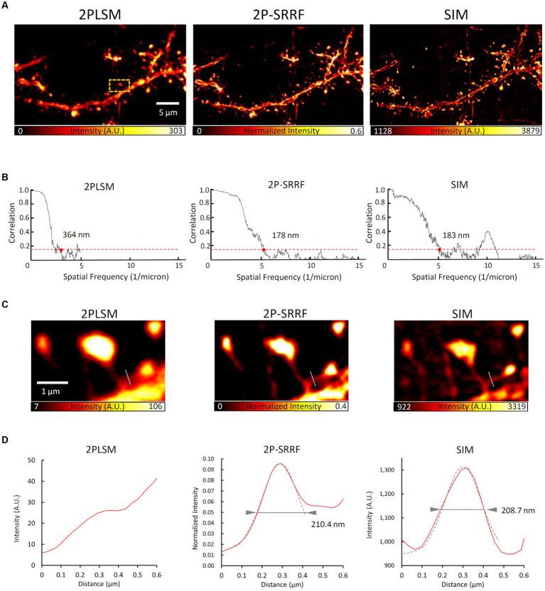 https://cdn.ncbi.nlm.nih.gov/pmc/blobs/076e/10595032/be130c655bfe/fncel-17-1243633-g004.jpg