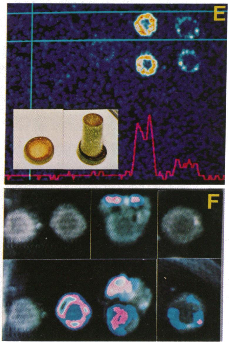 https://cdn.ncbi.nlm.nih.gov/pmc/blobs/0775/287101/f308ee7264b3/pnas00249-0240-d.jpg