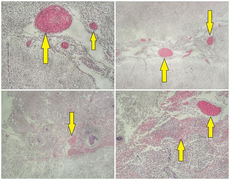 https://cdn.ncbi.nlm.nih.gov/pmc/blobs/0783/11154160/9f7824bdfd1e/cureus-0016-00000059782-i02.jpg