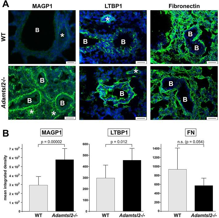https://cdn.ncbi.nlm.nih.gov/pmc/blobs/0784/4415891/93fce6dde9ce/DMM01704606.jpg