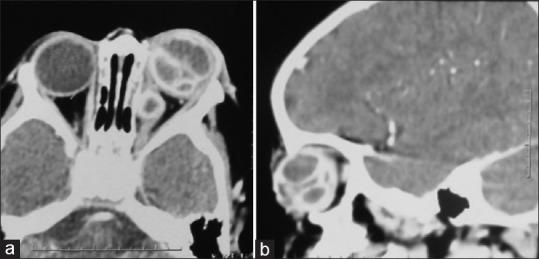 https://cdn.ncbi.nlm.nih.gov/pmc/blobs/078b/7849851/462f5295c49c/SJO-34-50-g003.jpg