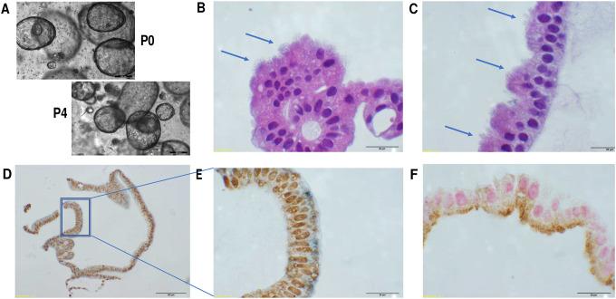 https://cdn.ncbi.nlm.nih.gov/pmc/blobs/078f/10246240/6daf53672341/nihpp-rs2891189v1-f0001.jpg
