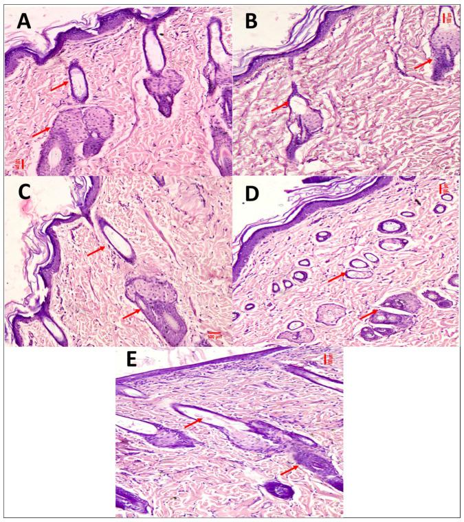 https://cdn.ncbi.nlm.nih.gov/pmc/blobs/0791/10675485/555c0c21e6c8/pharmaceutics-15-02594-g006.jpg