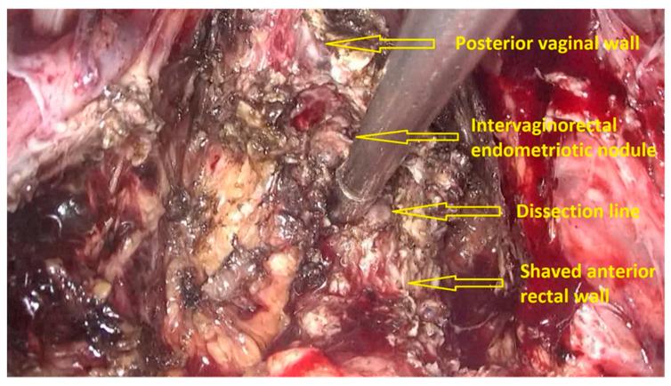 https://cdn.ncbi.nlm.nih.gov/pmc/blobs/079a/8153645/24389bfc9034/jpm-11-00408-g003.jpg