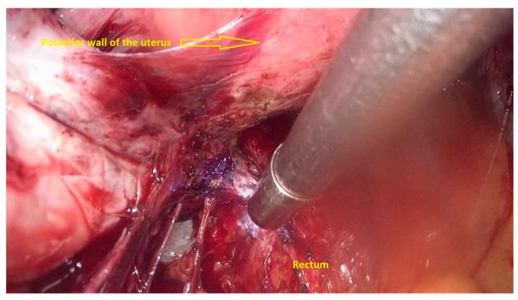 https://cdn.ncbi.nlm.nih.gov/pmc/blobs/079a/8153645/6a514761db12/jpm-11-00408-g004.jpg