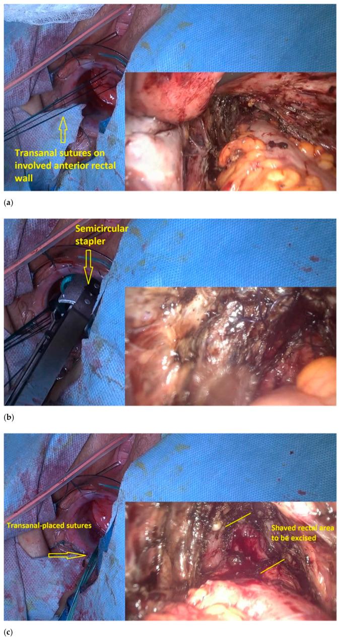 https://cdn.ncbi.nlm.nih.gov/pmc/blobs/079a/8153645/7ebc0ad0e63b/jpm-11-00408-g007a.jpg
