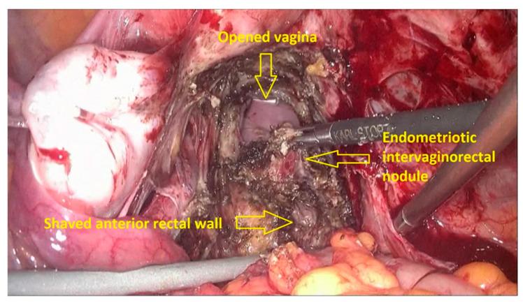 https://cdn.ncbi.nlm.nih.gov/pmc/blobs/079a/8153645/987438d2f056/jpm-11-00408-g006.jpg