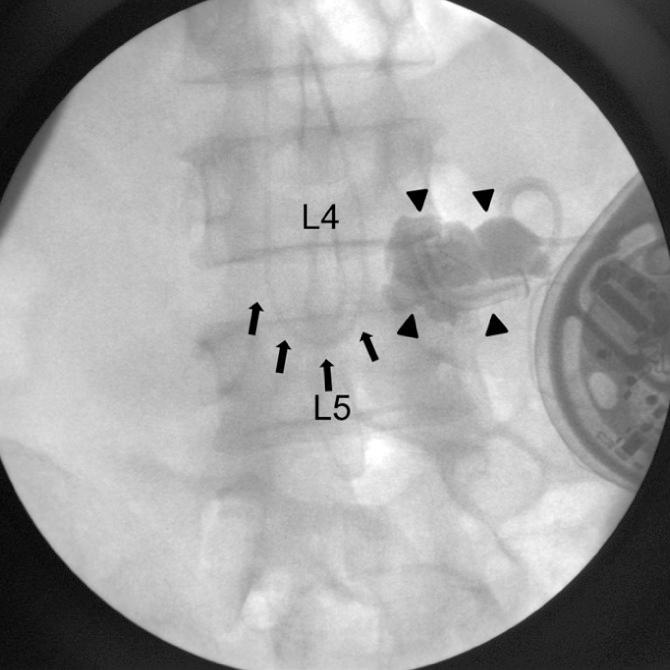 https://cdn.ncbi.nlm.nih.gov/pmc/blobs/079f/3468770/768c530901c1/jkms-27-1278-g002.jpg