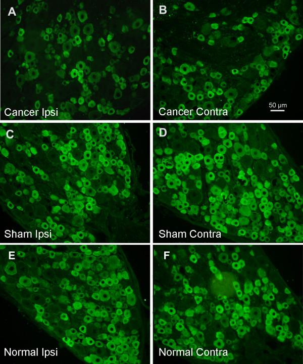 https://cdn.ncbi.nlm.nih.gov/pmc/blobs/07a5/2894792/109a2359a544/1471-2407-10-216-3.jpg