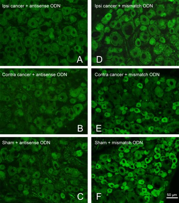https://cdn.ncbi.nlm.nih.gov/pmc/blobs/07a5/2894792/1672424c1343/1471-2407-10-216-5.jpg