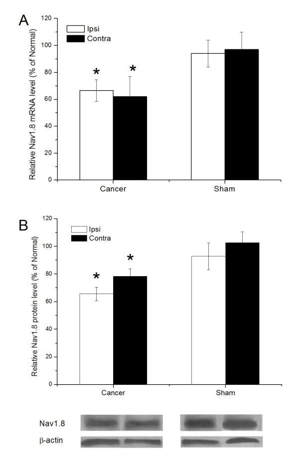 https://cdn.ncbi.nlm.nih.gov/pmc/blobs/07a5/2894792/677bd0bf2153/1471-2407-10-216-2.jpg