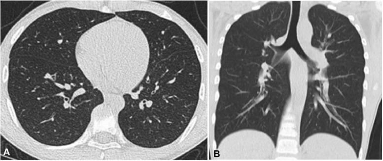 https://cdn.ncbi.nlm.nih.gov/pmc/blobs/07a7/7102535/253cbeb32d8f/gr1_lrg.jpg