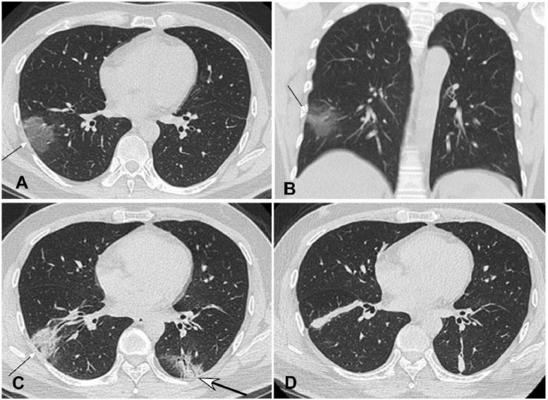 https://cdn.ncbi.nlm.nih.gov/pmc/blobs/07a7/7102535/62e3858d8bab/gr3_lrg.jpg