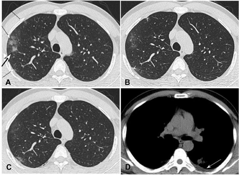 https://cdn.ncbi.nlm.nih.gov/pmc/blobs/07a7/7102535/b36310c90927/gr2_lrg.jpg
