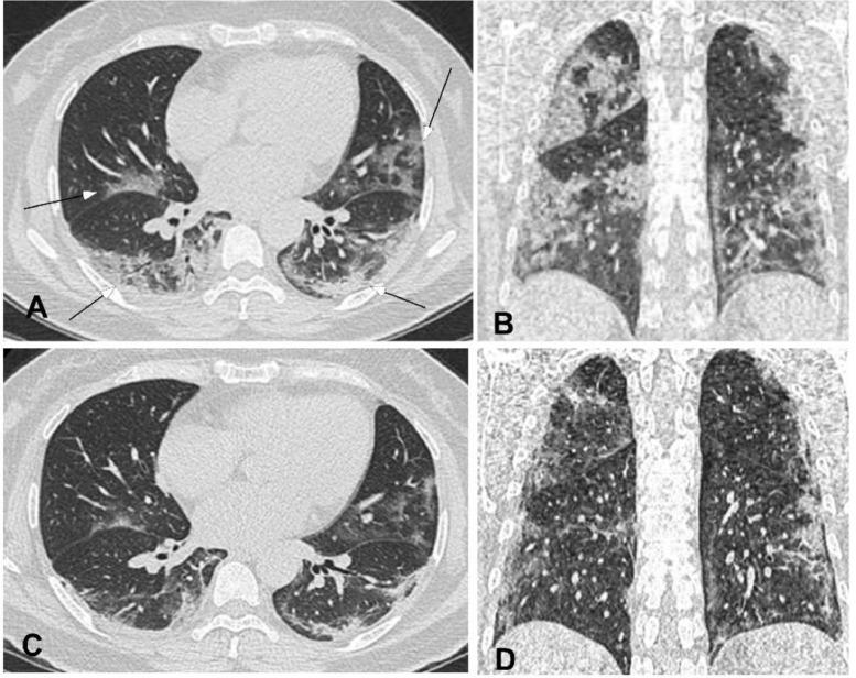 https://cdn.ncbi.nlm.nih.gov/pmc/blobs/07a7/7102535/bf37133e3abb/gr6_lrg.jpg