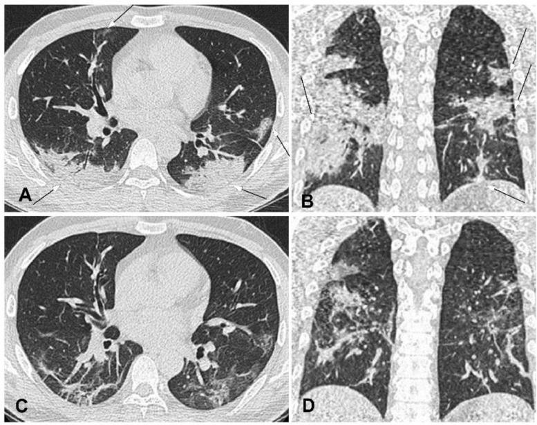 https://cdn.ncbi.nlm.nih.gov/pmc/blobs/07a7/7102535/f3ffbabbc7b8/gr4_lrg.jpg