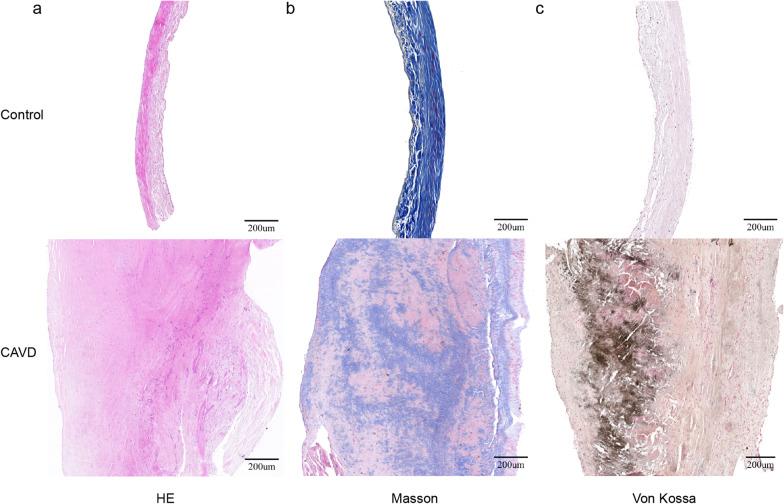 https://cdn.ncbi.nlm.nih.gov/pmc/blobs/07a9/8666063/4e1c782a964c/10020_2021_416_Fig1_HTML.jpg