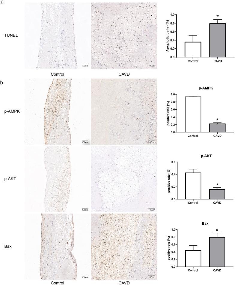 https://cdn.ncbi.nlm.nih.gov/pmc/blobs/07a9/8666063/55dd2773da66/10020_2021_416_Fig2_HTML.jpg