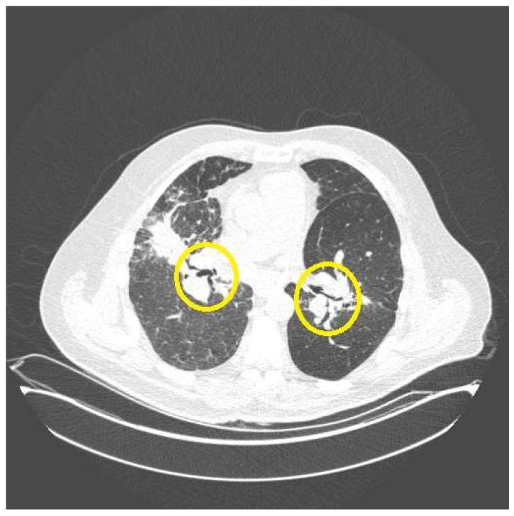 https://cdn.ncbi.nlm.nih.gov/pmc/blobs/07ad/10532418/ecbf25dd3275/jcm-12-06088-g002.jpg