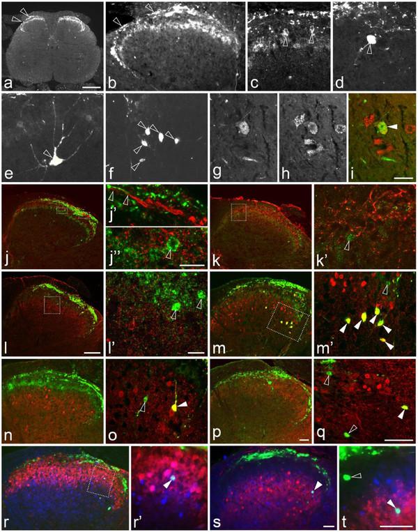 https://cdn.ncbi.nlm.nih.gov/pmc/blobs/07b3/3560279/299deaeb6bed/1744-8069-8-80-5.jpg