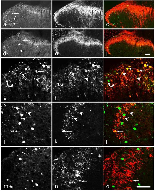 https://cdn.ncbi.nlm.nih.gov/pmc/blobs/07b3/3560279/89ce386328e0/1744-8069-8-80-7.jpg