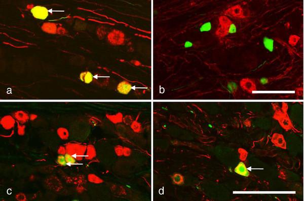 https://cdn.ncbi.nlm.nih.gov/pmc/blobs/07b3/3560279/b07b02dd2e76/1744-8069-8-80-4.jpg