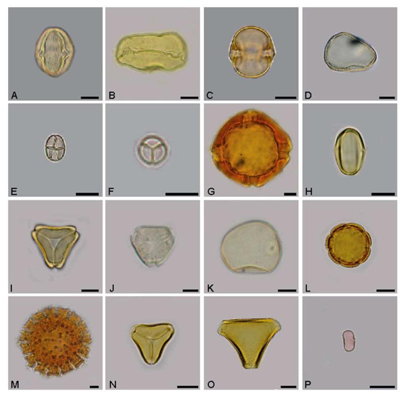 https://cdn.ncbi.nlm.nih.gov/pmc/blobs/07bc/10673356/6d0eafe7599e/microorganisms-11-02779-g001.jpg