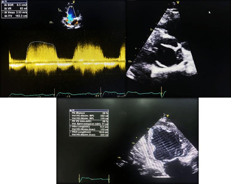https://cdn.ncbi.nlm.nih.gov/pmc/blobs/07c5/11233094/94b62415703e/cureus-0016-00000062011-i04.jpg