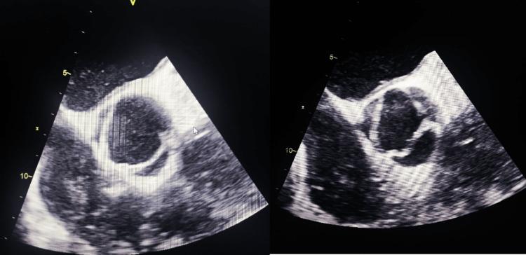 https://cdn.ncbi.nlm.nih.gov/pmc/blobs/07c5/11233094/e7dbdd38da76/cureus-0016-00000062011-i03.jpg