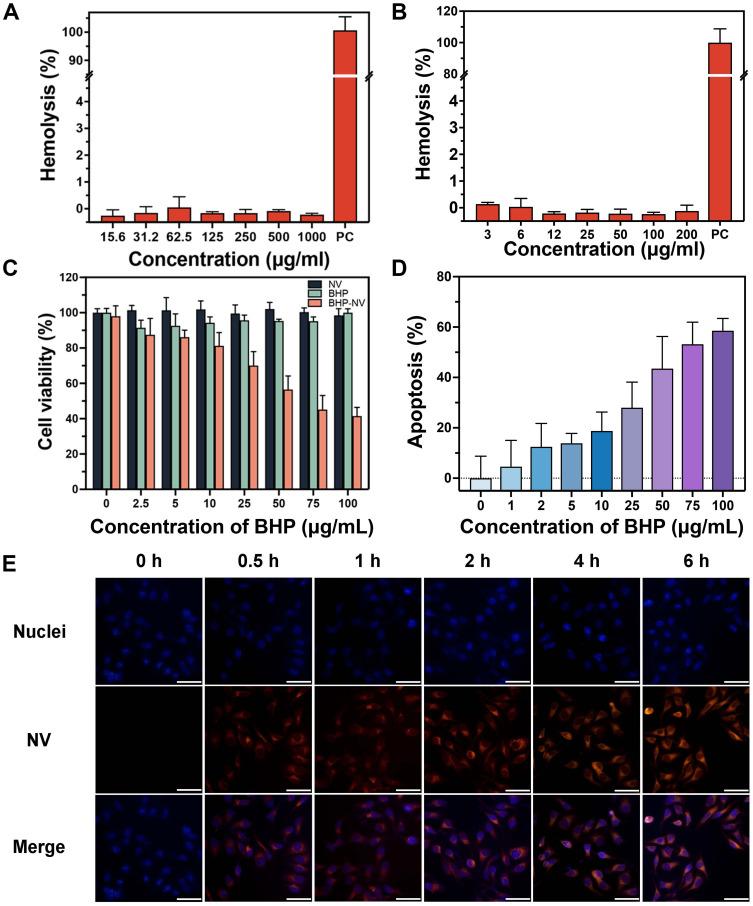 https://cdn.ncbi.nlm.nih.gov/pmc/blobs/07c6/10517702/e1eb21a0aa98/IJN-18-5343-g0007.jpg