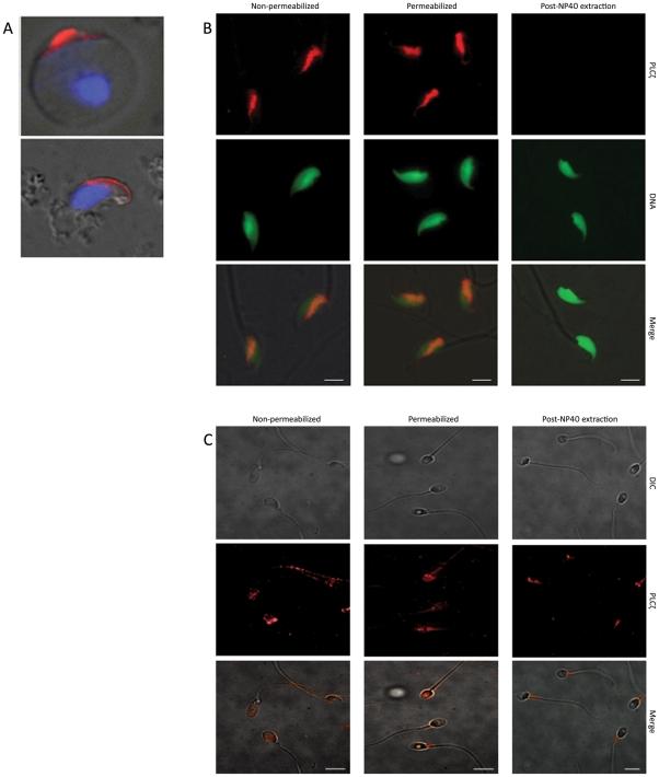 https://cdn.ncbi.nlm.nih.gov/pmc/blobs/07c7/3299792/c04c549b5529/pone.0033496.g004.jpg