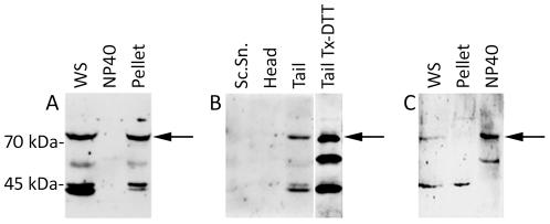https://cdn.ncbi.nlm.nih.gov/pmc/blobs/07c7/3299792/d9c214360d10/pone.0033496.g001.jpg