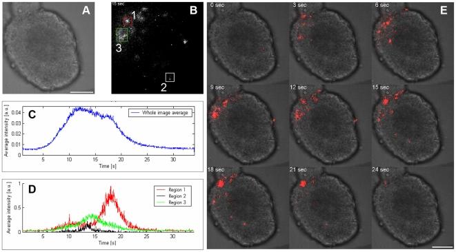 https://cdn.ncbi.nlm.nih.gov/pmc/blobs/07c9/2811732/878948a79d8c/pone.0008882.g008.jpg