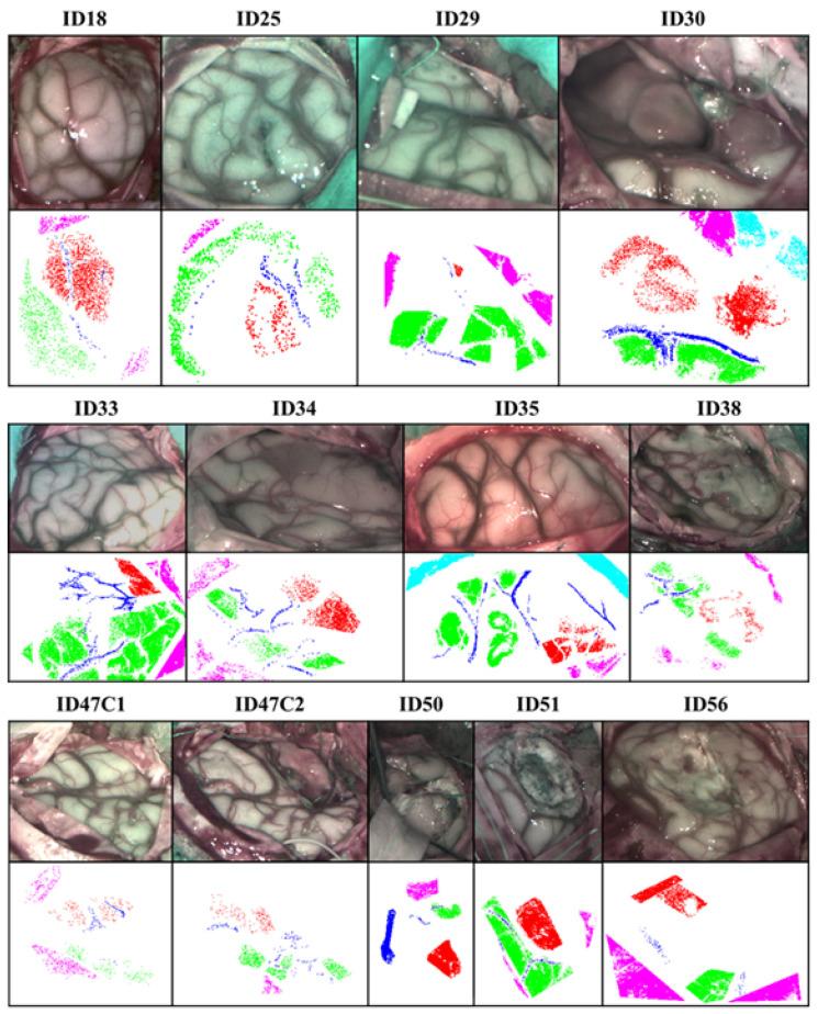 https://cdn.ncbi.nlm.nih.gov/pmc/blobs/07d3/8199064/8a5e6a03e3a4/sensors-21-03827-g004.jpg