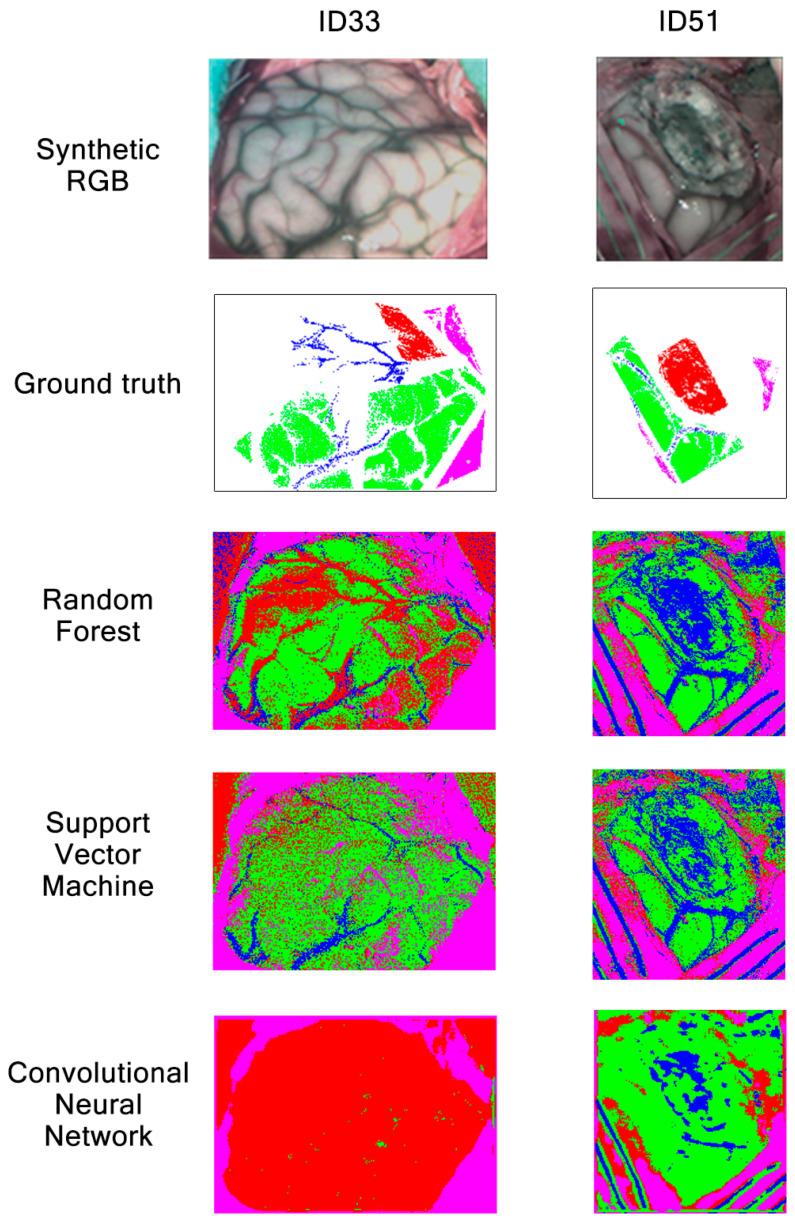https://cdn.ncbi.nlm.nih.gov/pmc/blobs/07d3/8199064/973dbb12aade/sensors-21-03827-g020.jpg