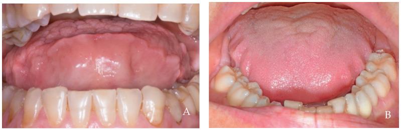 https://cdn.ncbi.nlm.nih.gov/pmc/blobs/07d5/11275616/fd0c823b415d/dentistry-12-00216-g007.jpg