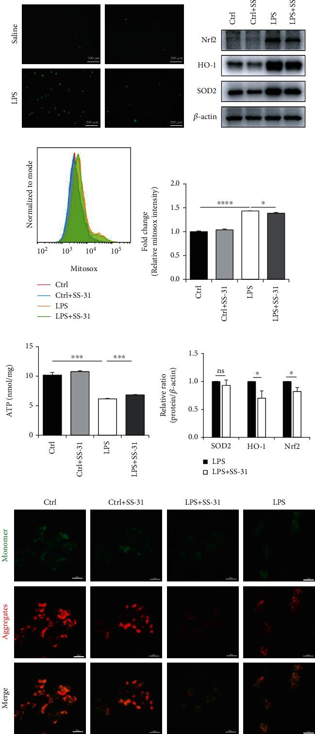 https://cdn.ncbi.nlm.nih.gov/pmc/blobs/07d6/8057883/69ea94cb4548/OMCL2021-6662156.006.jpg
