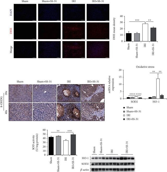 https://cdn.ncbi.nlm.nih.gov/pmc/blobs/07d6/8057883/cd679f4dd0d2/OMCL2021-6662156.002.jpg