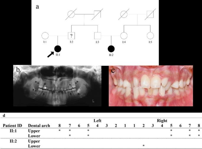 https://cdn.ncbi.nlm.nih.gov/pmc/blobs/07e4/9763662/0ce2ac1f0c0d/joddd-16-107-g001.jpg