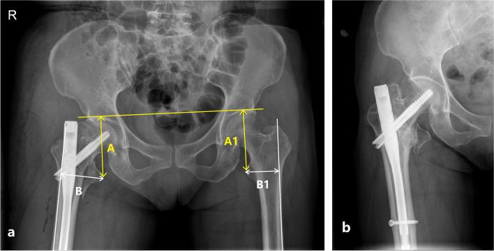 https://cdn.ncbi.nlm.nih.gov/pmc/blobs/07f4/9215053/a3f8ea4937bd/12891_2022_5534_Fig2_HTML.jpg