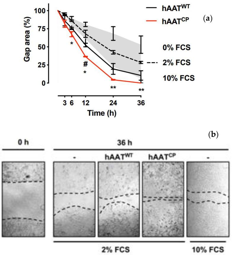 https://cdn.ncbi.nlm.nih.gov/pmc/blobs/0802/9266325/7815cf08cf0a/ijms-23-07364-g001.jpg