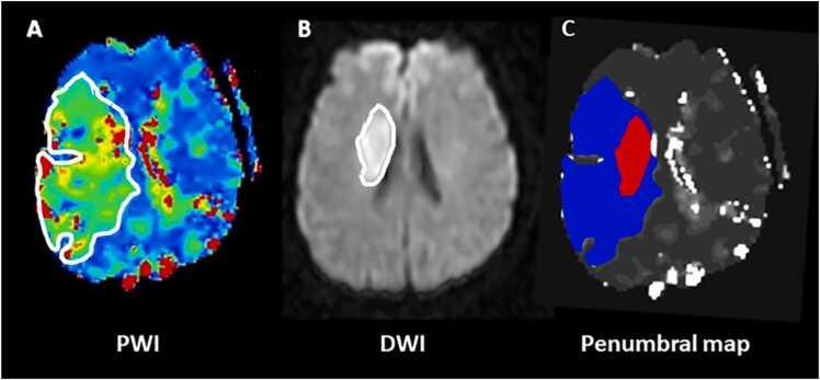 https://cdn.ncbi.nlm.nih.gov/pmc/blobs/0805/10523426/b1e6d0431e75/gr1.jpg