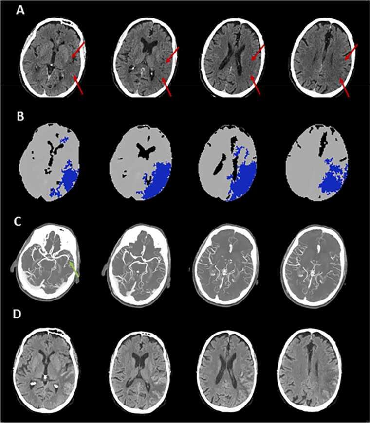 https://cdn.ncbi.nlm.nih.gov/pmc/blobs/0805/10523426/c88c38bfa2eb/gr6.jpg