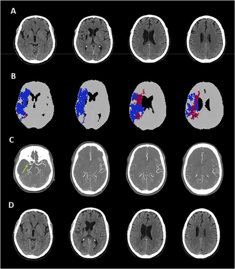 https://cdn.ncbi.nlm.nih.gov/pmc/blobs/0805/10523426/f0c416ba5f8c/gr7.jpg
