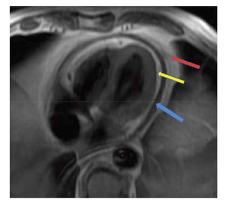 https://cdn.ncbi.nlm.nih.gov/pmc/blobs/080a/6131401/cf518b947e20/CCR-14-200_F5.jpg