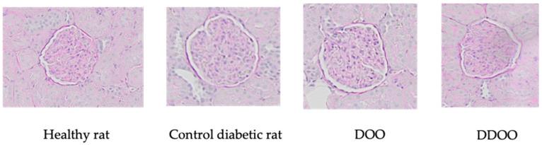https://cdn.ncbi.nlm.nih.gov/pmc/blobs/0812/11357248/cb5bbf5a8778/nutrients-16-02794-g003.jpg