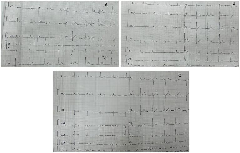 https://cdn.ncbi.nlm.nih.gov/pmc/blobs/0816/12358373/1861cac53830/fmed-12-1600067-g003.jpg