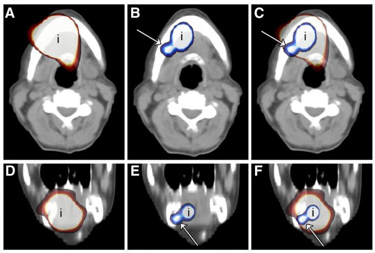 https://cdn.ncbi.nlm.nih.gov/pmc/blobs/081d/7589685/34aa979b75ca/cancers-12-03055-g006.jpg