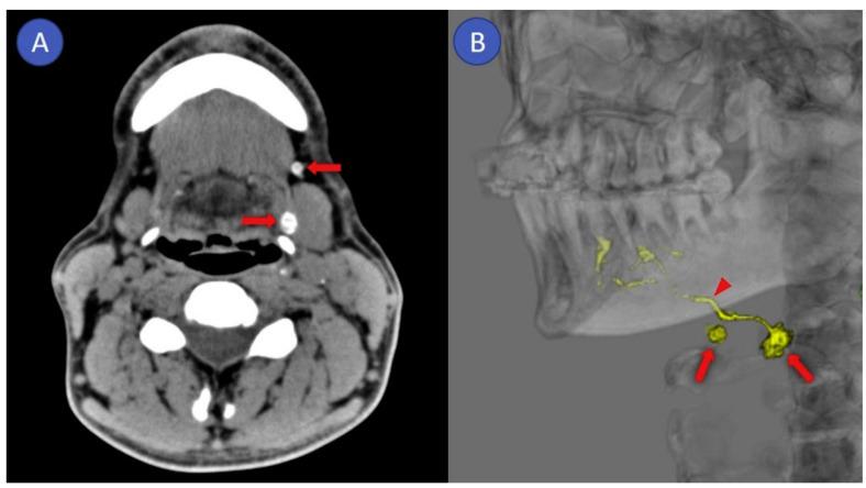 https://cdn.ncbi.nlm.nih.gov/pmc/blobs/081d/7589685/7efe9e8ecc16/cancers-12-03055-g005.jpg